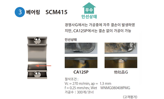 ca125p_case3